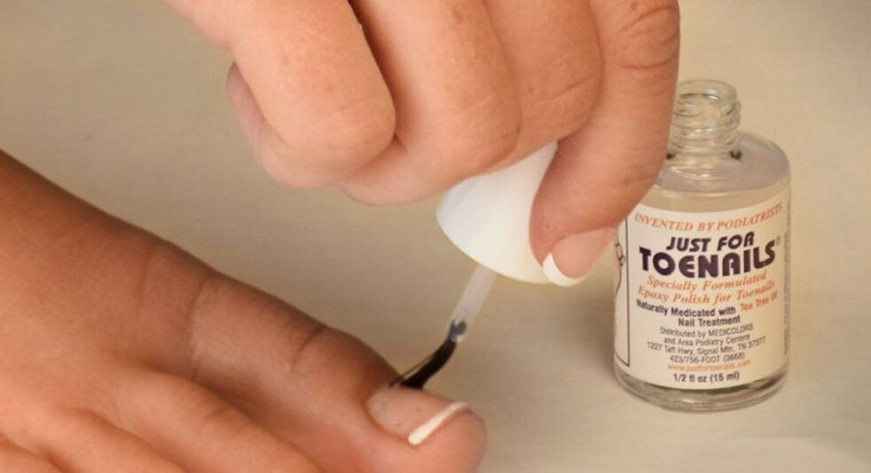 Esmalte de uñas contra hongos en el dedo gordo del pie.