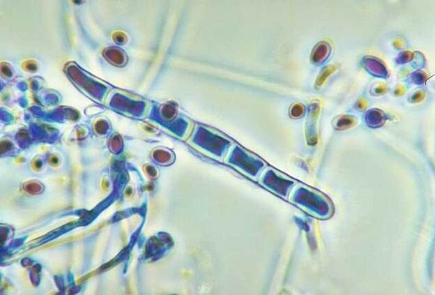 patógenos de las infecciones por hongos
