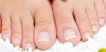 Prevención de la apariencia del hongo en las uñas de las piernas
