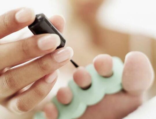 Tratar las uñas con esmalte de uñas para una infección por hongos.