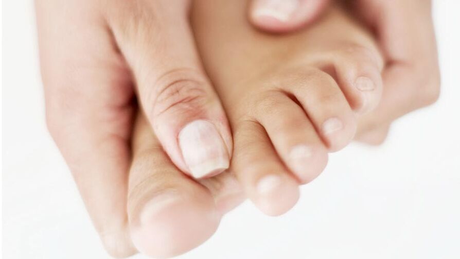 Picazón causada por hongos en las uñas del dedo gordo del pie.